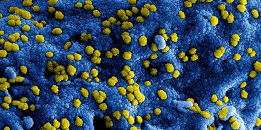 afbeelding COVID-19 virus